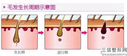 激光脱毛光子脱毛整形效果好不好「激光脱毛光子脱毛的效果怎么样，有副作用吗」