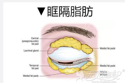 适合做双眼皮手术的最佳人群