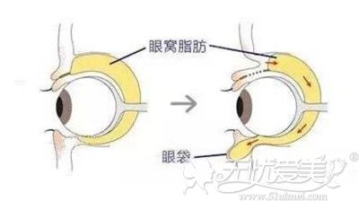 小炳坦言超爱整容