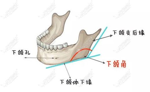 成都西部中西医院结合医院下颌角磨骨技术图