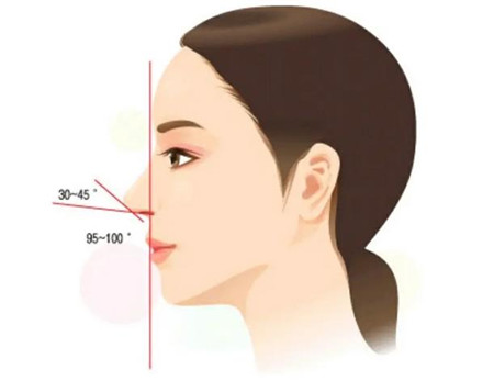 隆鼻假体取出多少钱？骨粉隆鼻取出大概费用？