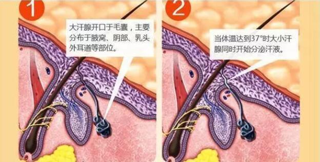 昆明云医大医院腋臭科答：遗传腋臭到了后期还会传染吗？