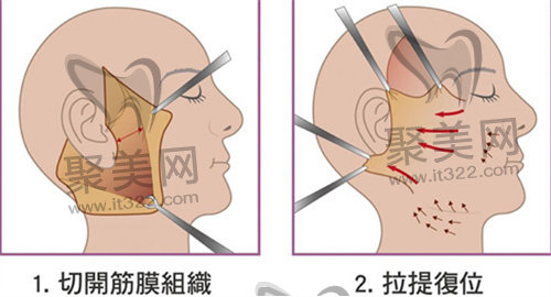 黄广香医生怎么预约？