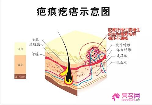 广州市中西医结合医院烧伤整形外科怎么样？医生信息与疤痕修复手术案例