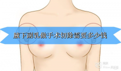 今天解答腋下副乳做手术切除需要多少钱