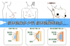 小编今天说说假体隆胸多少钱 假体隆胸维持多久