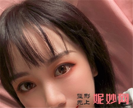 在北京华韩找谢立宁做的眼部多项，术后90天双眼皮很好看