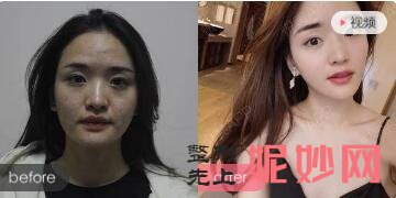 北京联合丽格是三甲公立医院?整形失败?联合丽格整形技术_案例口碑_价格