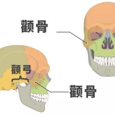 邱立东：颧骨内推后变丑是怎么回事?