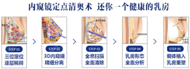 内窥镜清奥主优势