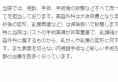 日本丰胸+隆鼻整形大师【高柳进医生案例】及整形价格表